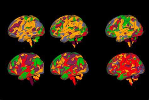 Brain scans from one person build reliable map of brain activity | Spectrum | Autism Research News