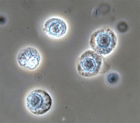 Proximal renal tubular cells with round shape, large nucleus and granular cytoplasm. Phase ...