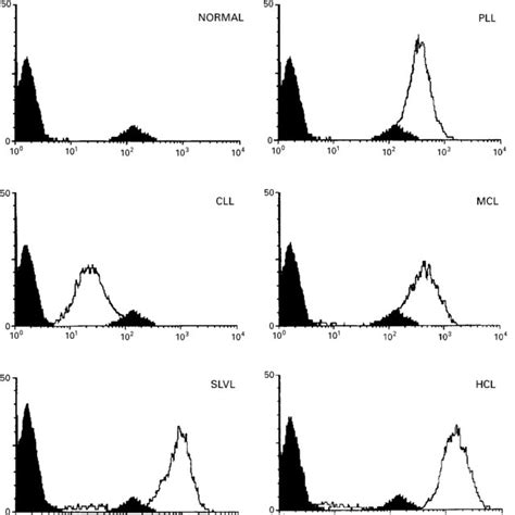 (PDF) Levels of expression of CD19 and CD20 in chronic B cell leukaemias