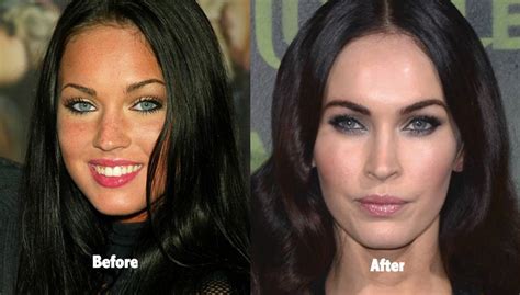 Megan Fox Before and After Plastic Surgery: A Tale of Evolution | ASEAN TV