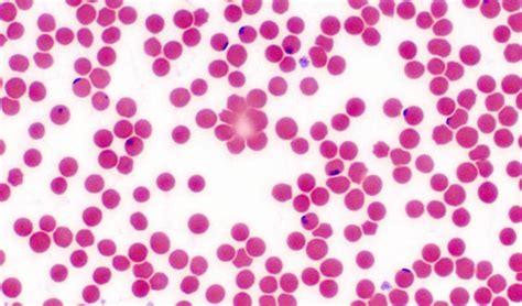 Babesiosis in Dogs | PetCoach