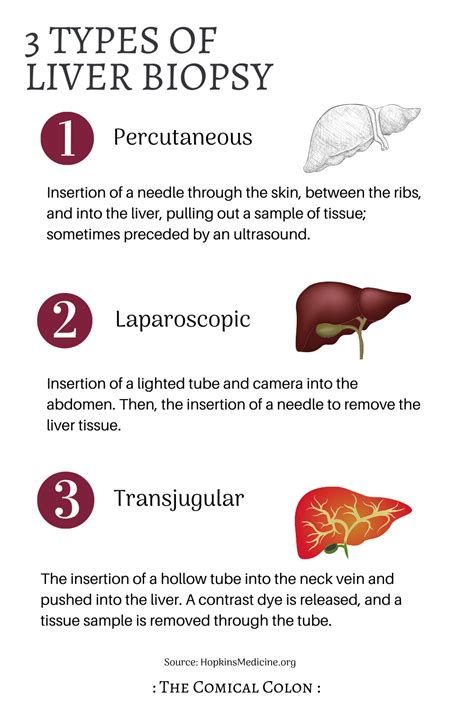 What to Expect at your Ultrasound-Guided Liver Biopsy Procedure