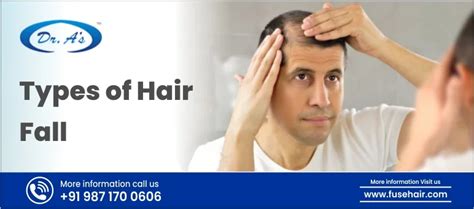 What Are The Different Types Of Hair Losses And Causes - FuseHair