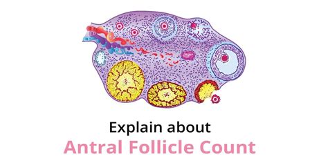 Understanding Antral Follicle Count (AFC) | Birla Fertility & IVF