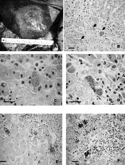 Necropsy revealed the massive necrotic areas. Various sizes from 1 to... | Download Scientific ...