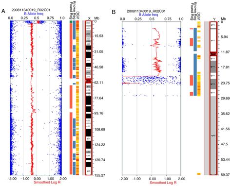 Prenatal diagnosis of sex chromosome mosaicism with two marker chromosomes in three cell lines ...