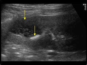 Urinary Tract and male reproductive system | 2.1 Kidney and ureter ...