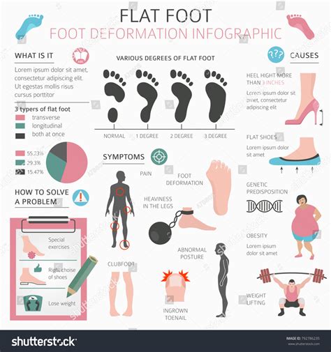 Foot Deformation Medical Desease Infographic Causes Stock Vector (Royalty Free) 792786235 ...