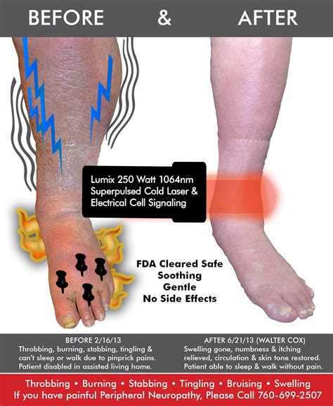 Foot-Ankle Pain – Dr. Phillip Yoo