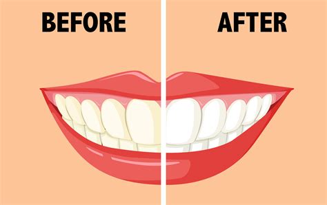 Before and after brushing teeth 293918 Vector Art at Vecteezy