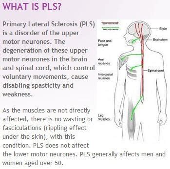 13 best images about Primary Lateral Sclerosis/Spastic Paraplegia on ...