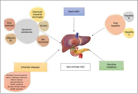 💌 Hepatoblastoma causes. Hepatoblastoma in Children: What You Need to Know. 2022-11-09