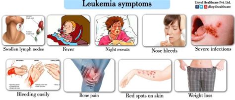 Chronic Lymphocytic Leukemia | Leukemia symptoms, Leukemia, Childhood cancer awareness