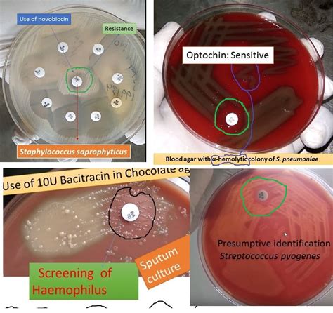 Diagnostic antimicrobial agents: Introduction, working mechanism, uses