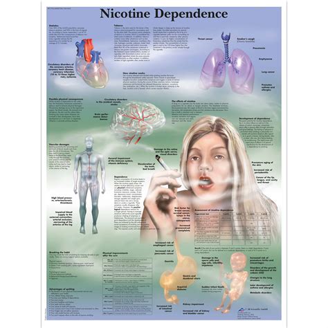 Nicotine Dependence Chart - 4006728 - 3B Scientific - VR1793UU - Tobacco Charts and Posters ...