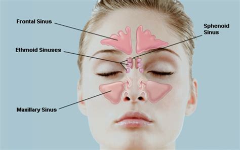 Sinus surgery with no cuts | Sinusitis & sinus surgery in Gurgaon