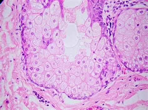 Histología en Imágenes : GLANDULA SEROSA O MUCOSA??