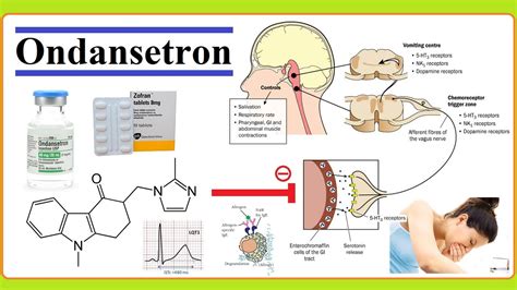 ondansetron - YouTube