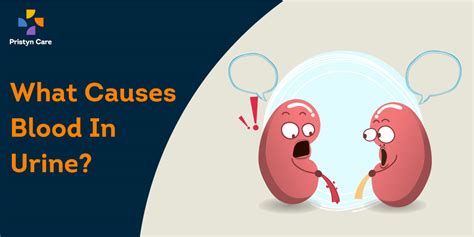 What Causes Blood in Urine? - Pristyn Care