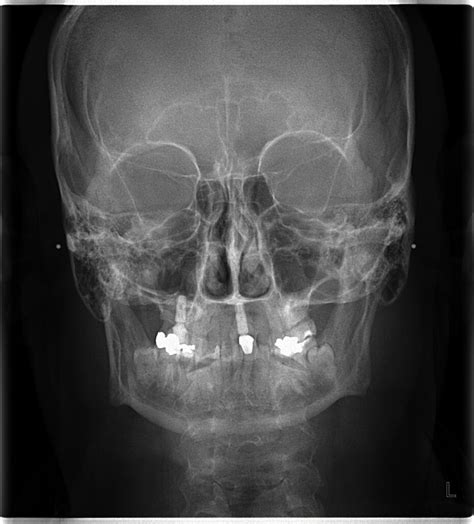 CEPH X-Ray | Dental Scan Ltd