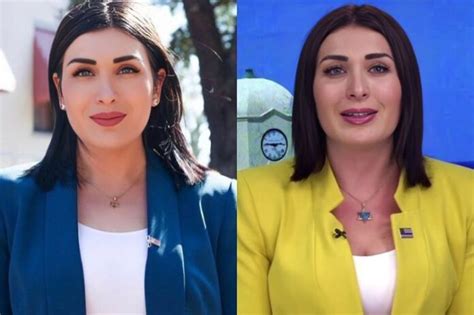 Laura Loomer Plastic Surgery: Before & After Snapshots Analyzed