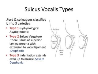 Sulcus vocalis | PPT