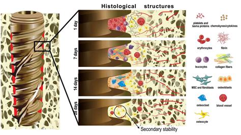 Osseointegration in Dental Implant: Definition, Benefits & Processes