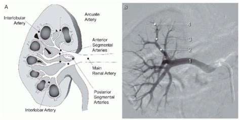 Renal Arterial Anatomy Radiology