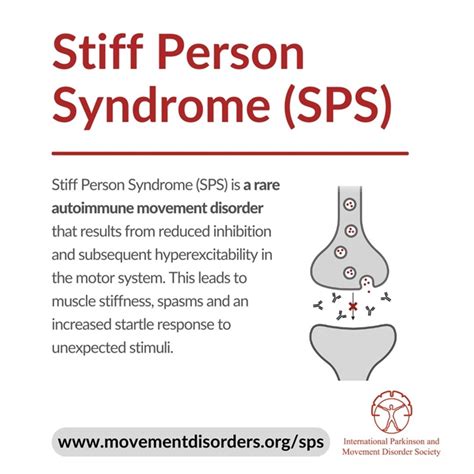 Stiff-Person syndrome - PerditaWesal