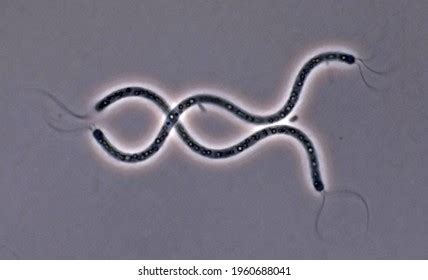 Two Spiral Bacteria Microscope Image Living Stock Photo 1960688041 | Shutterstock