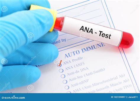 ANA test stock image. Image of laboratory, disease, peroxidase - 102159897