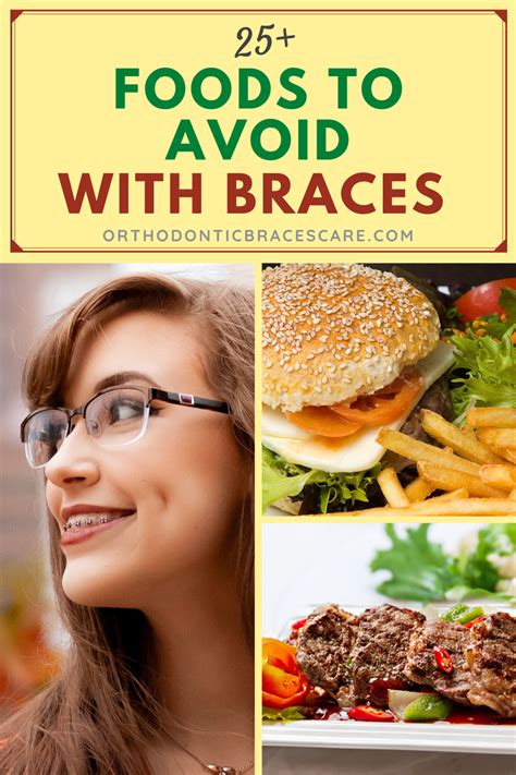 25+ Foods To Avoid With Braces | Foods to avoid, Food, Braces food