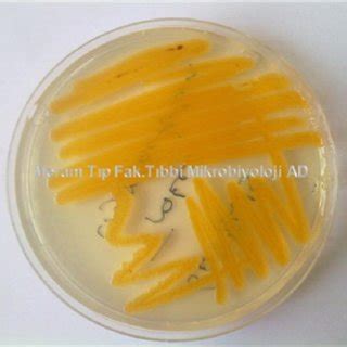 (PDF) PULMONARY INFECTION CAUSED BY CHRYSEOBACTERIUM INDOLOGENES IN A PATIENT WITH A DIAGNOSIS ...