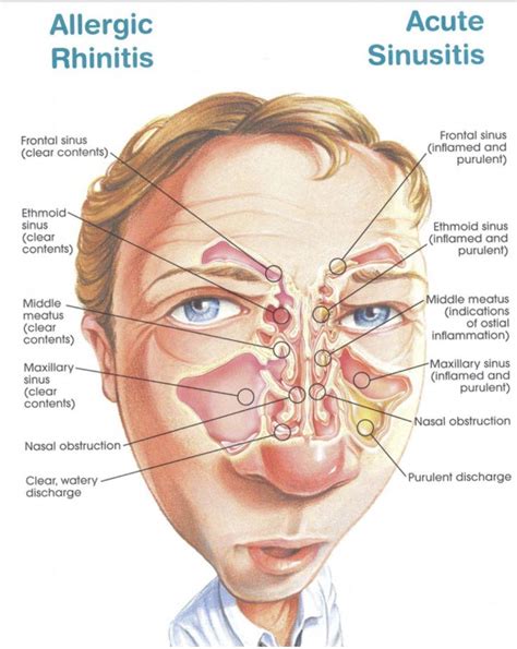 Ear Sinus Diagram