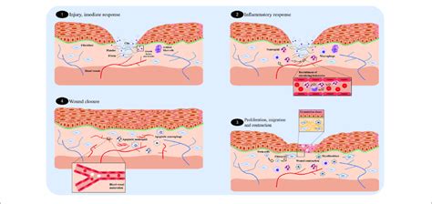 Surgical Wound Healing Stages