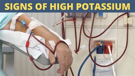 Signs And Symptoms Of High Potassium | Hyperkalemia Symptoms - YouTube