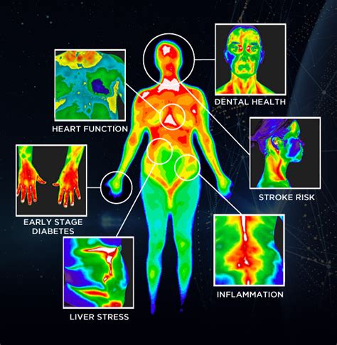 Medical Thermal Imaging – Psy Tek Labs