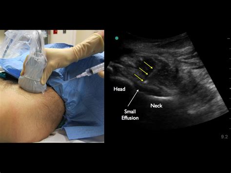 Procedures — Highland EM Ultrasound Fueled pain management