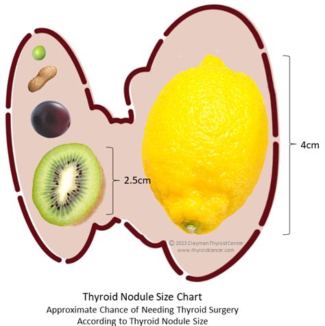 Things to Know About Thyroid Nodule Size, Plus Size Chart