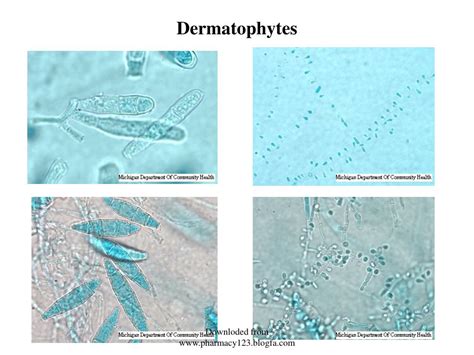 Dermatophyte Identification Chart