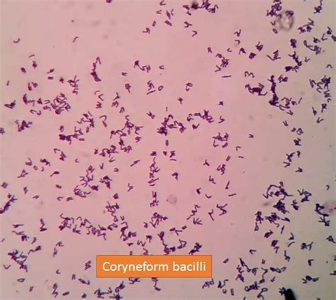 Corynebacterium Xerosis Morphology