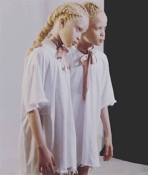 albino-twins-models-lara-mara-brasil