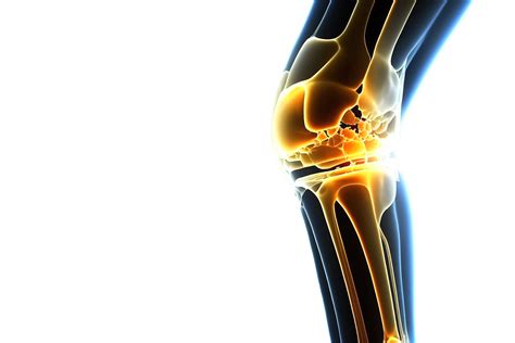 Free Knee injury illuminated by neon light. Skeleton of human leg ...