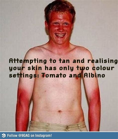 Funny Meme For Sunburn - Captions Cute Viral