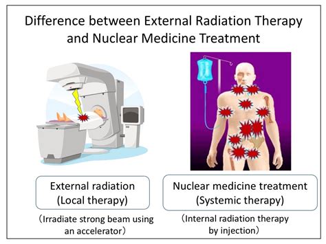 Breakthrough alpha-ray treatment of cancer without external radiation - ResOU