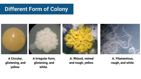 Colony Morphology of Bacteria and Examples - Biology Notes Online