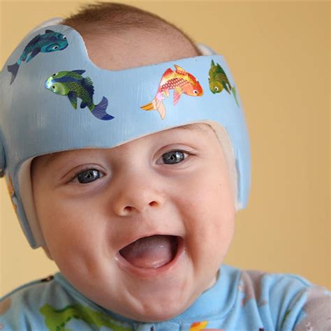 Baby Helmet Therapy: Parent FAQs - HealthyChildren.org