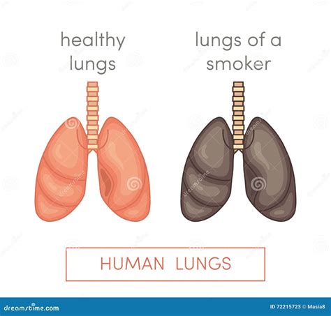 Smoker s lungs stock illustration. Illustration of illness - 72215723