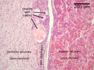 pituitary histology labeled | Pituitary Histology - Pituitary gland (labels) - histology slide ...