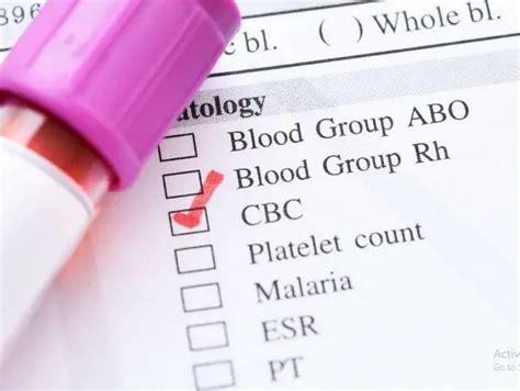 MPV Blood Test - Normal range, Results, Interpretation (High and Low ...